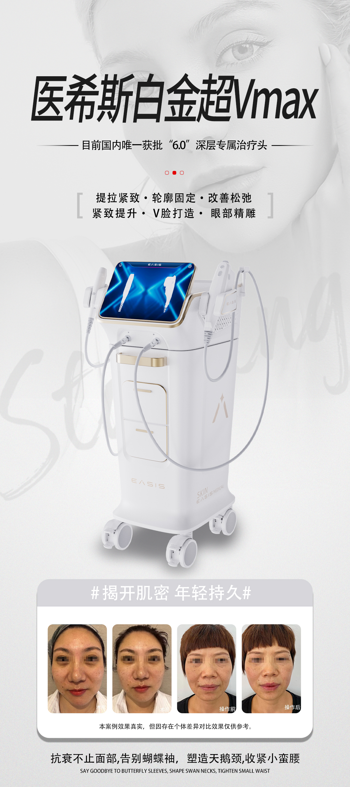 Vmax clinical case